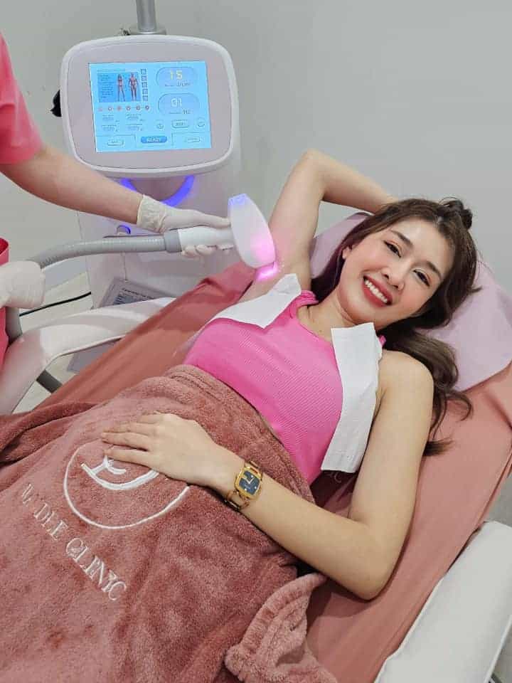 𝐋𝐚𝐬𝐞𝐫 กำจัดขนรักแร้