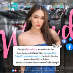 รีวิวความประทับใจฟิลเลอร์ใต้ตา