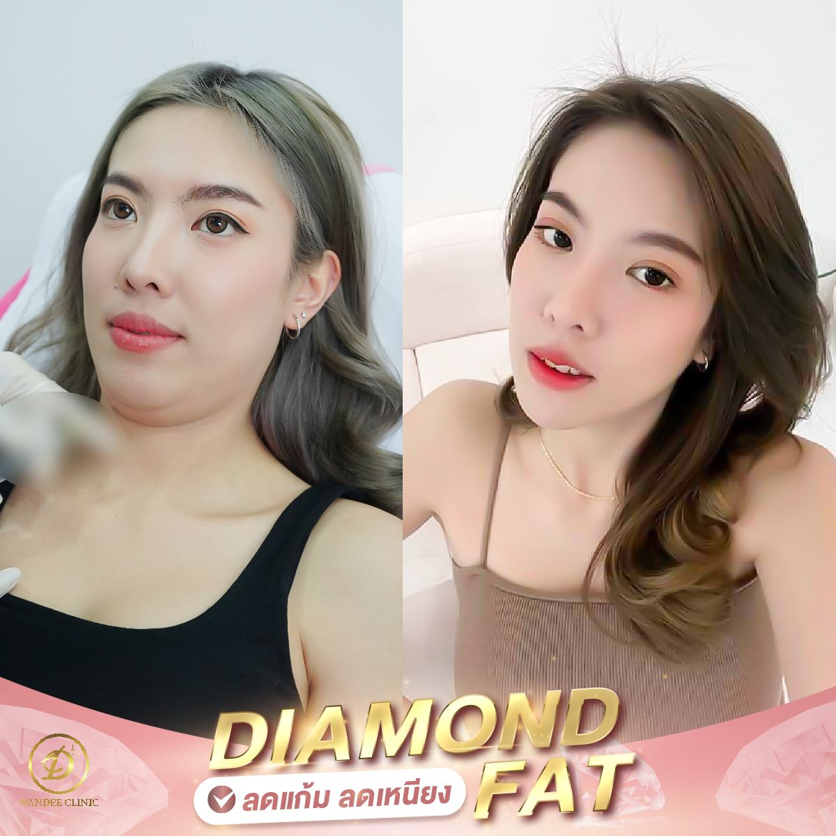 Diamond Fat ดีไหม