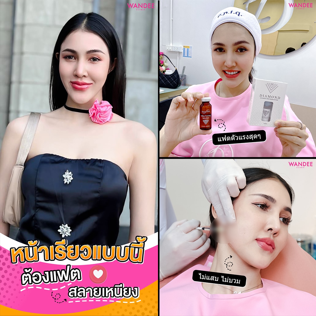 Diamond Fat ดีไหม