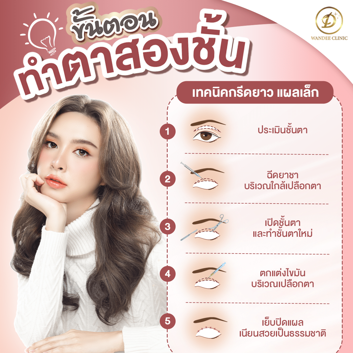 ศัลยกรรมตาสองชั้น