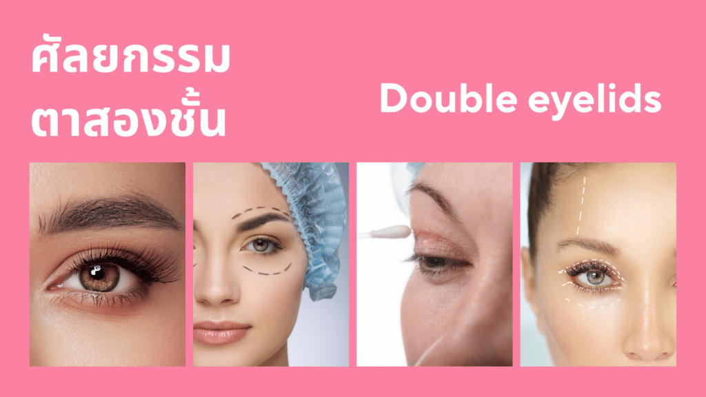 ศัลยกรรมตาสองชั้น