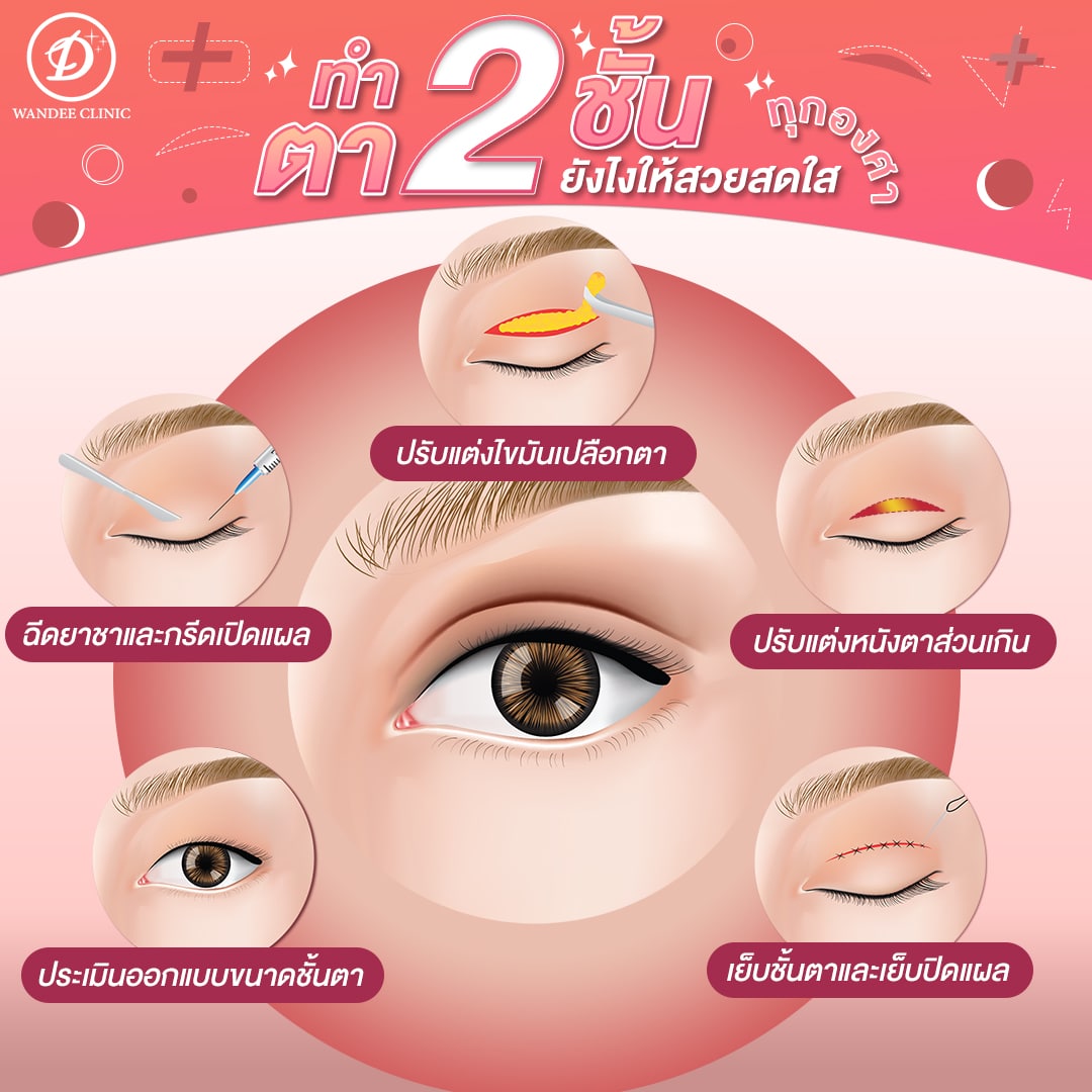 ศัลยกรรมตาสองชั้น