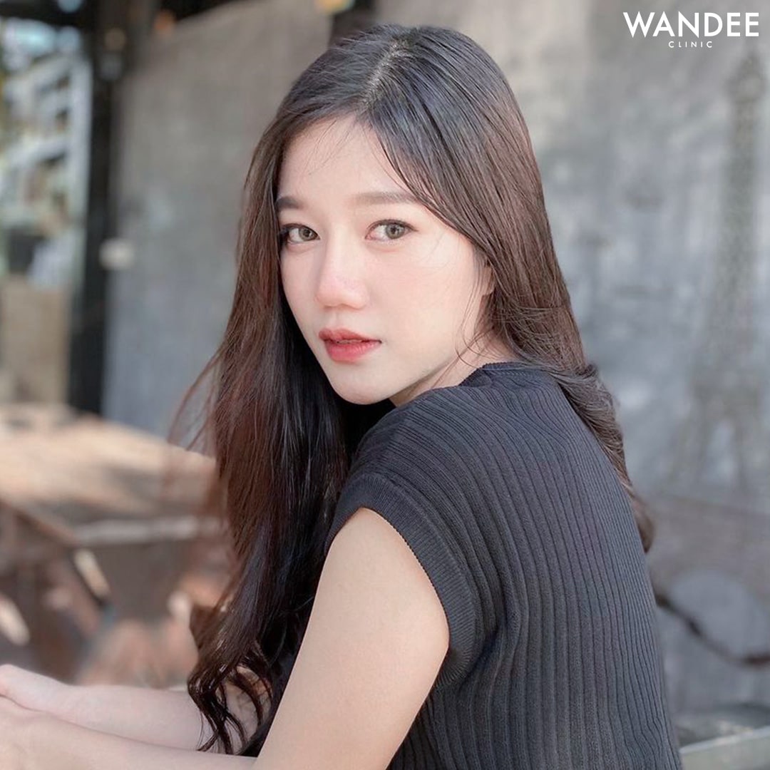 เติมร่องแก้ม เต็มฟู