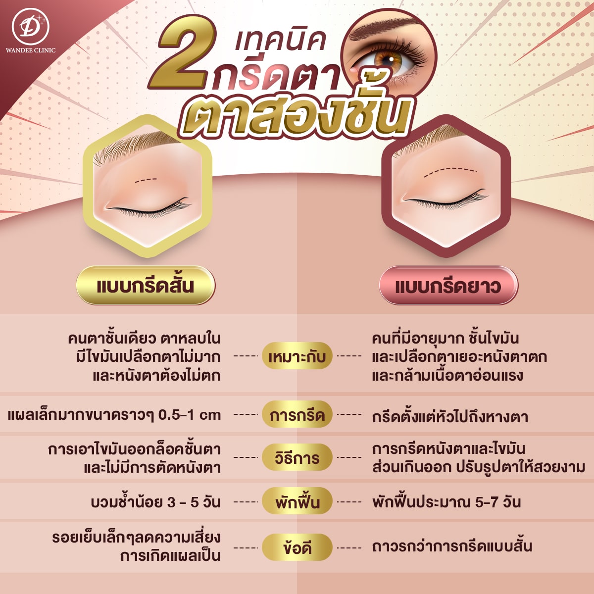 ตาสองชั้น คืออะไร