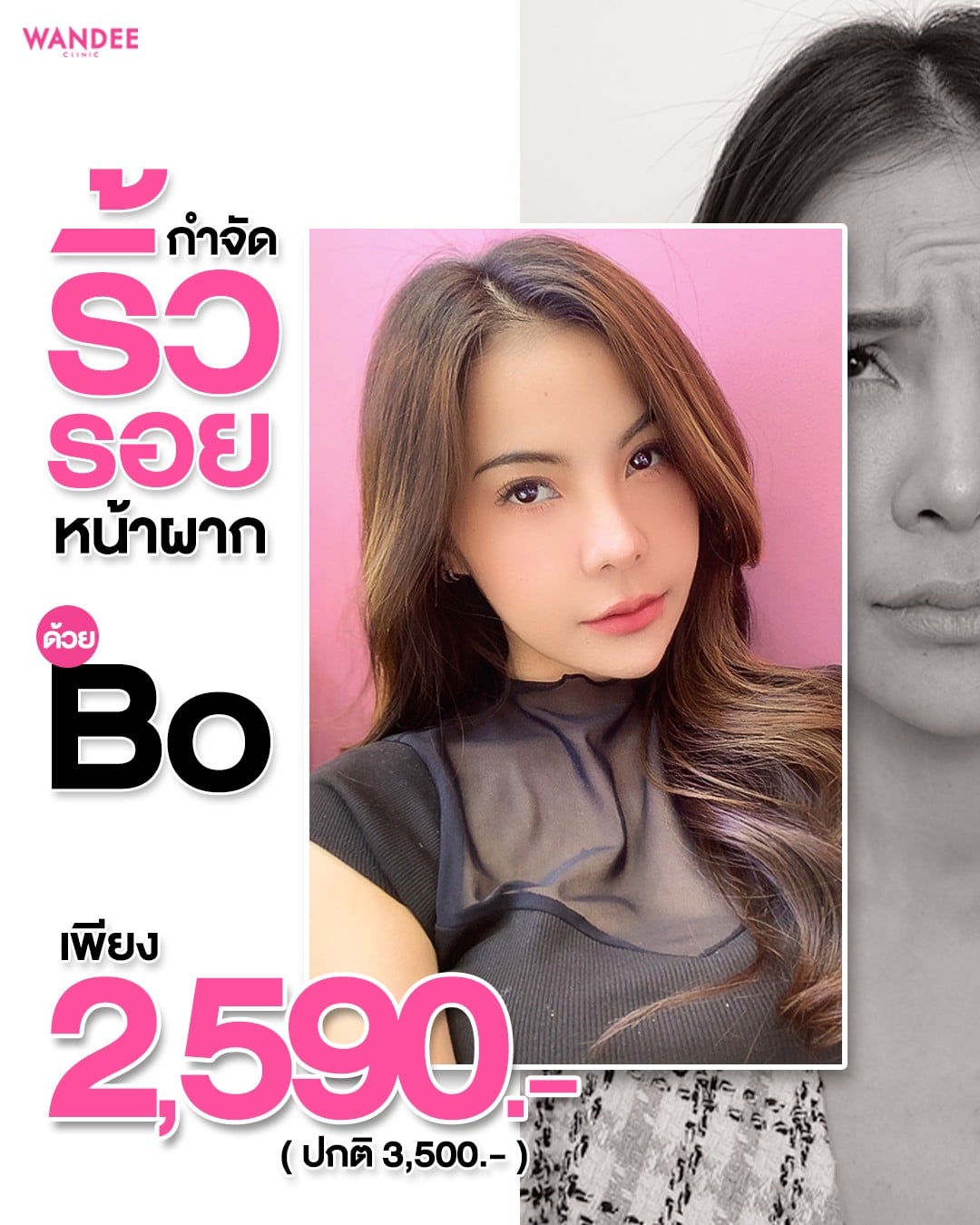 𝗕𝗢 ลดริ้วรอย