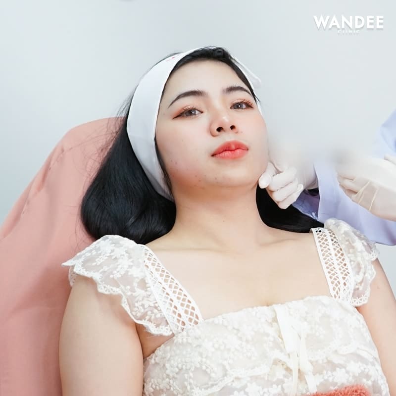 𝗙𝗔𝗧 ลดแก้มเหนียง