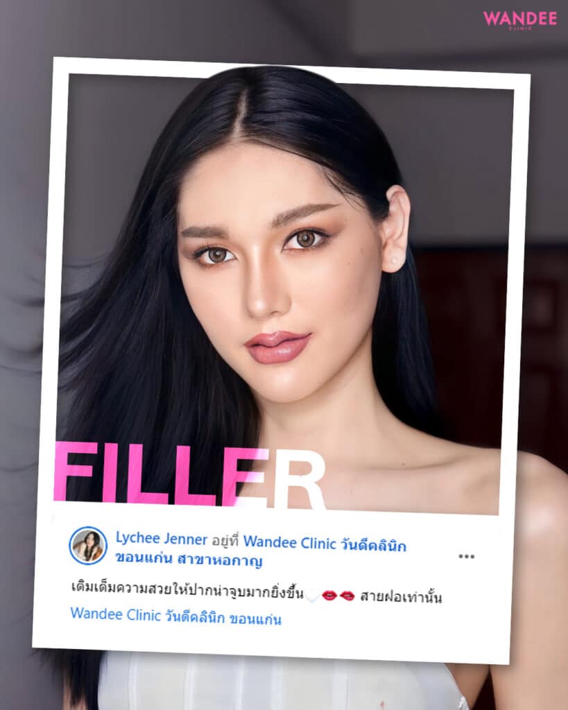 รีวิวความประทับใจ K.ลิ้นจี่