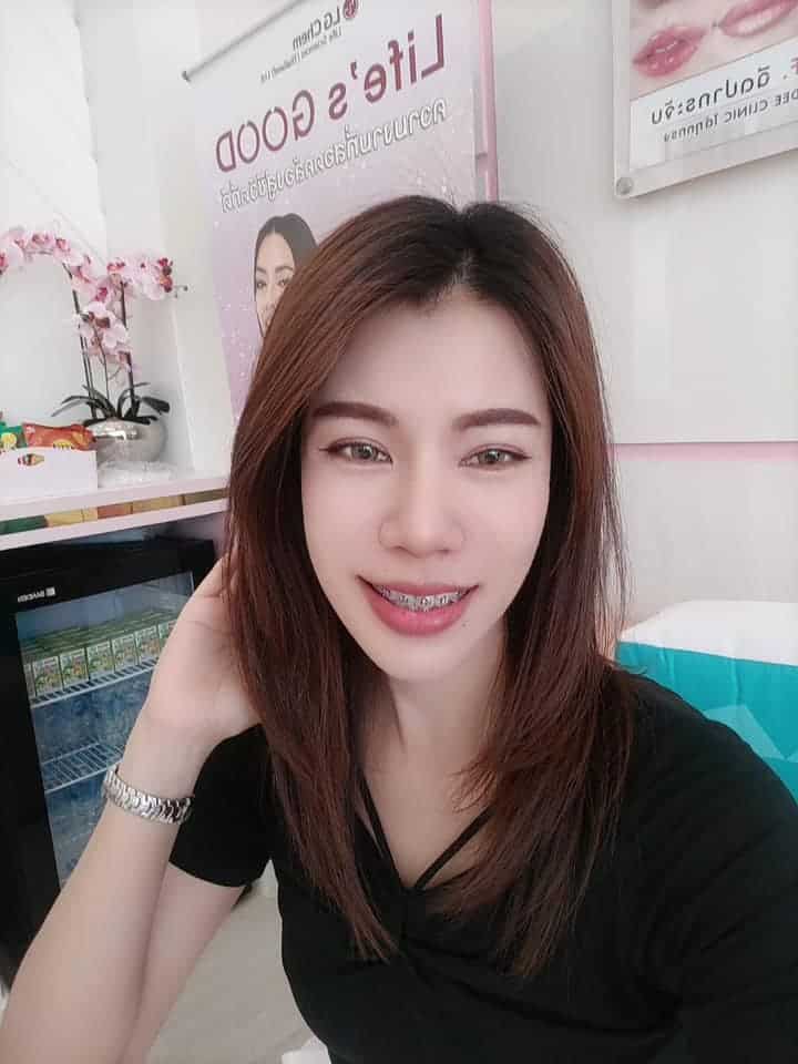 𝗙𝗶𝗹𝗹𝗲𝗿 เติมขมับ