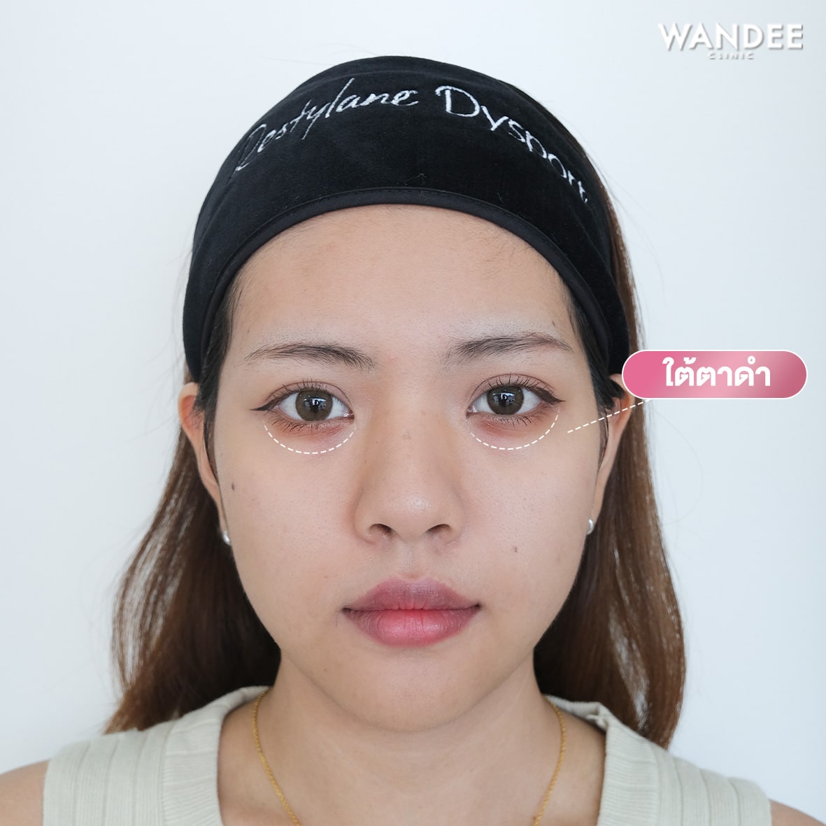𝗣𝗿𝗼𝗴𝗿𝗮𝗺 𝗙𝗶𝗹𝗹𝗲𝗿 ใต้ตา