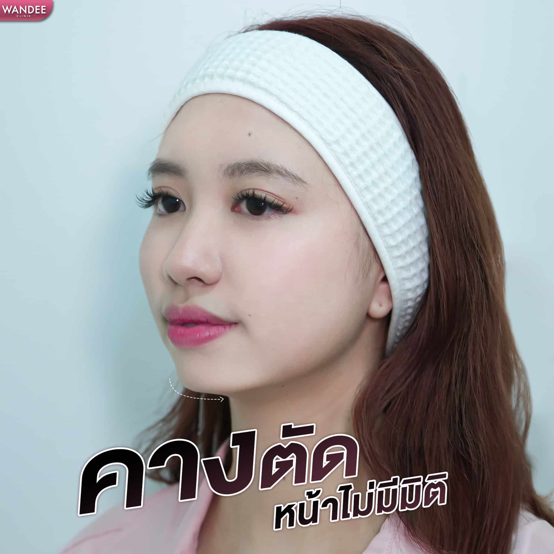 𝗣𝗿𝗼𝗴𝗿𝗮𝗺 𝗙𝗶𝗹𝗹𝗲𝗿 คาง