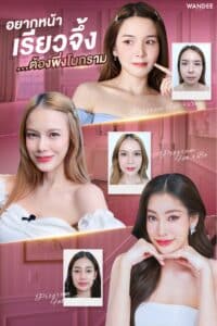 𝐏𝐫𝐨𝐠𝐫𝐚𝐦 𝐁𝐨𝐭𝐮𝐥𝐢𝐧𝐮𝐦 𝐓𝐨𝐱𝐢𝐧 ปรับหน้าเรียว