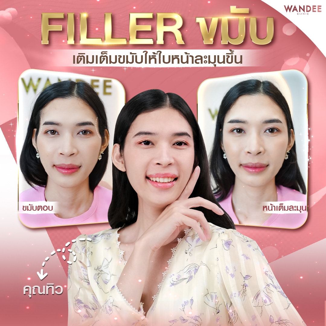 𝗣𝗿𝗼𝗴𝗿𝗮𝗺 𝗙𝗶𝗹𝗹𝗲𝗿 ปรับรูปหน้าเป๊ะ