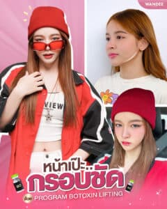 𝗣𝗿𝗼𝗴𝗿𝗮𝗺 𝗕𝗼𝘁𝘂𝗹𝗶𝗻𝘂𝗺 𝗧𝗼𝘅𝗶𝗻 ลิฟต์กรอบหน้า