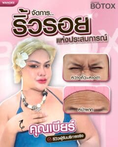 ริ้วรอยแห่งประสบการณ์