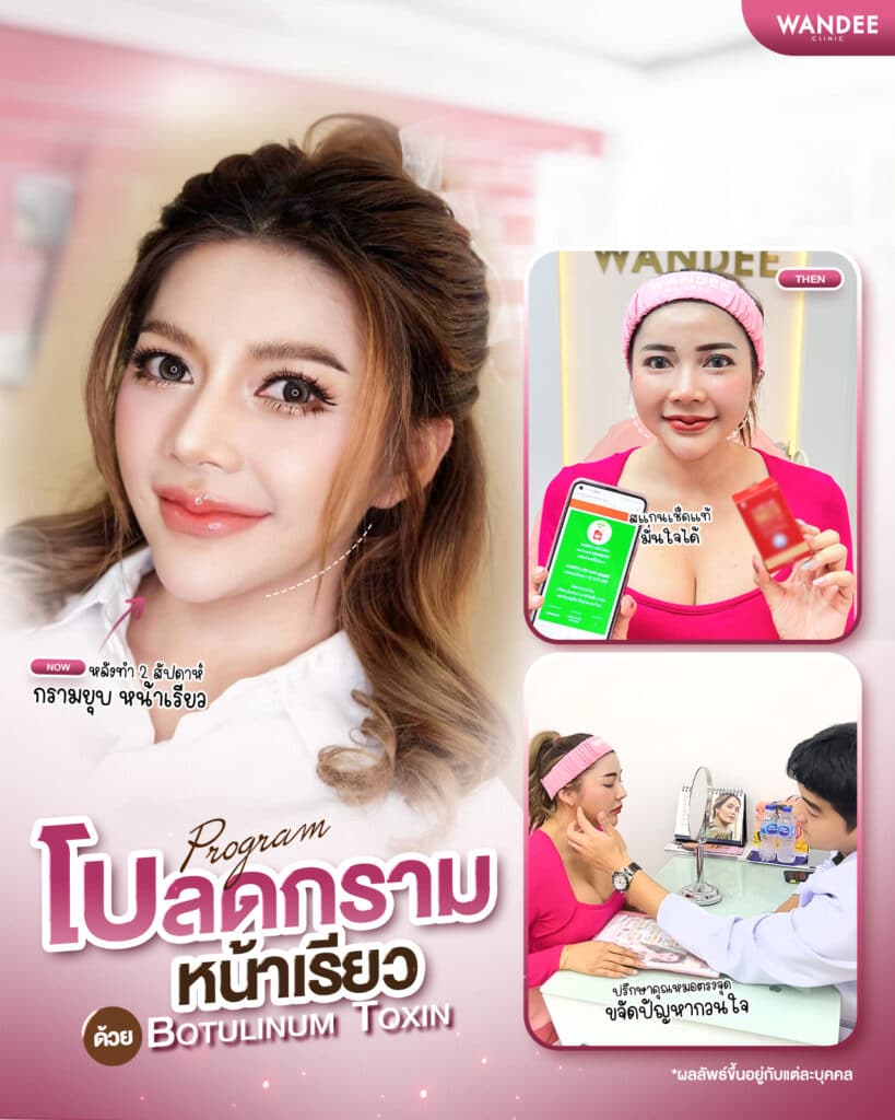 โบลดกราม หน้าเรียว