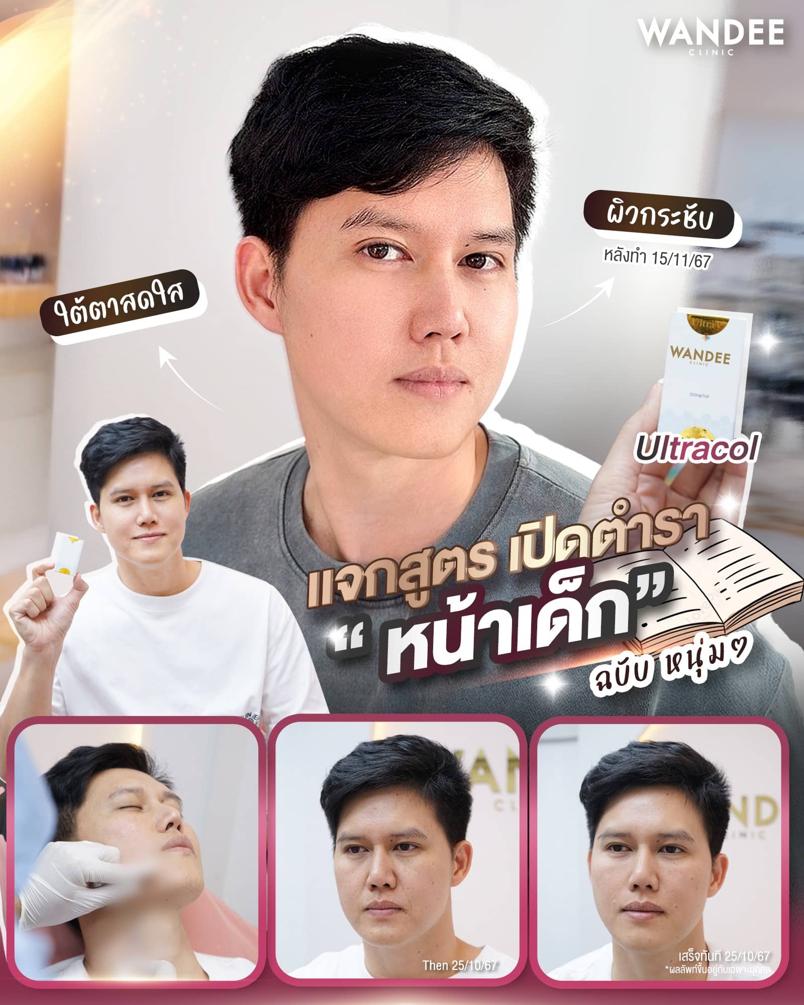 รีวิว อุลตราคอล หรือ อัลตราคอล วันดีคลินิก