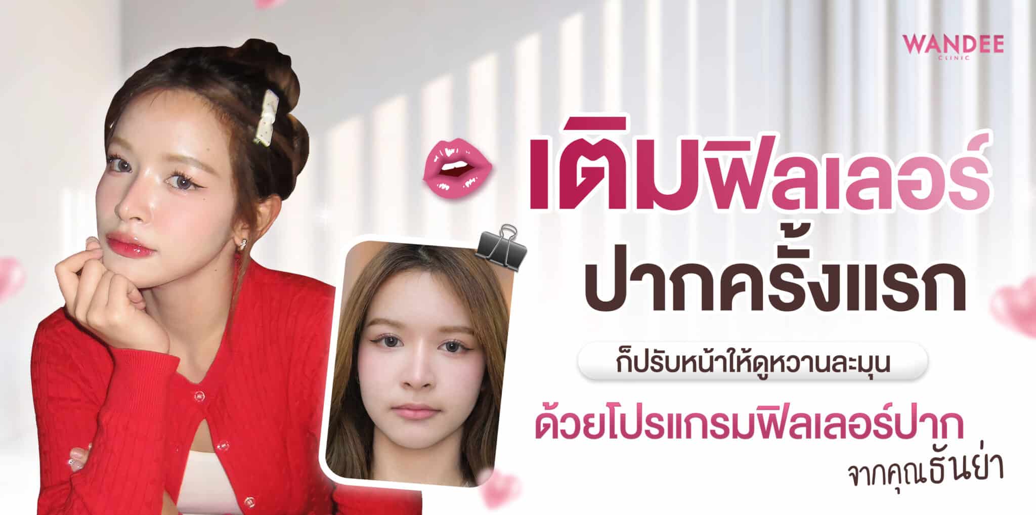 ฟิลเลอร์ปาก ธันย่า