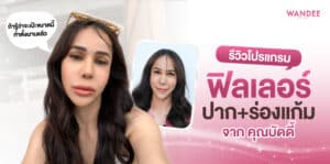 รีวิวโปรแกรม-ฟิลเลอร์-บัดดี้