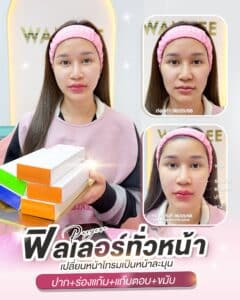 เปลี่ยนหน้าโทรมเป็นหน้าละมุน