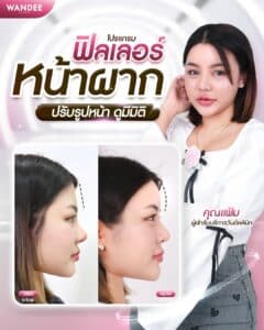 𝗙𝗶𝗹𝗹𝗲𝗿 หน้าผาก โหงวเฮ้งปัง