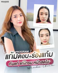 กันแก่ แก้โทรม