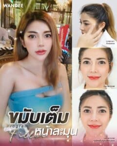 ขมับเต็มหน้าละมุน