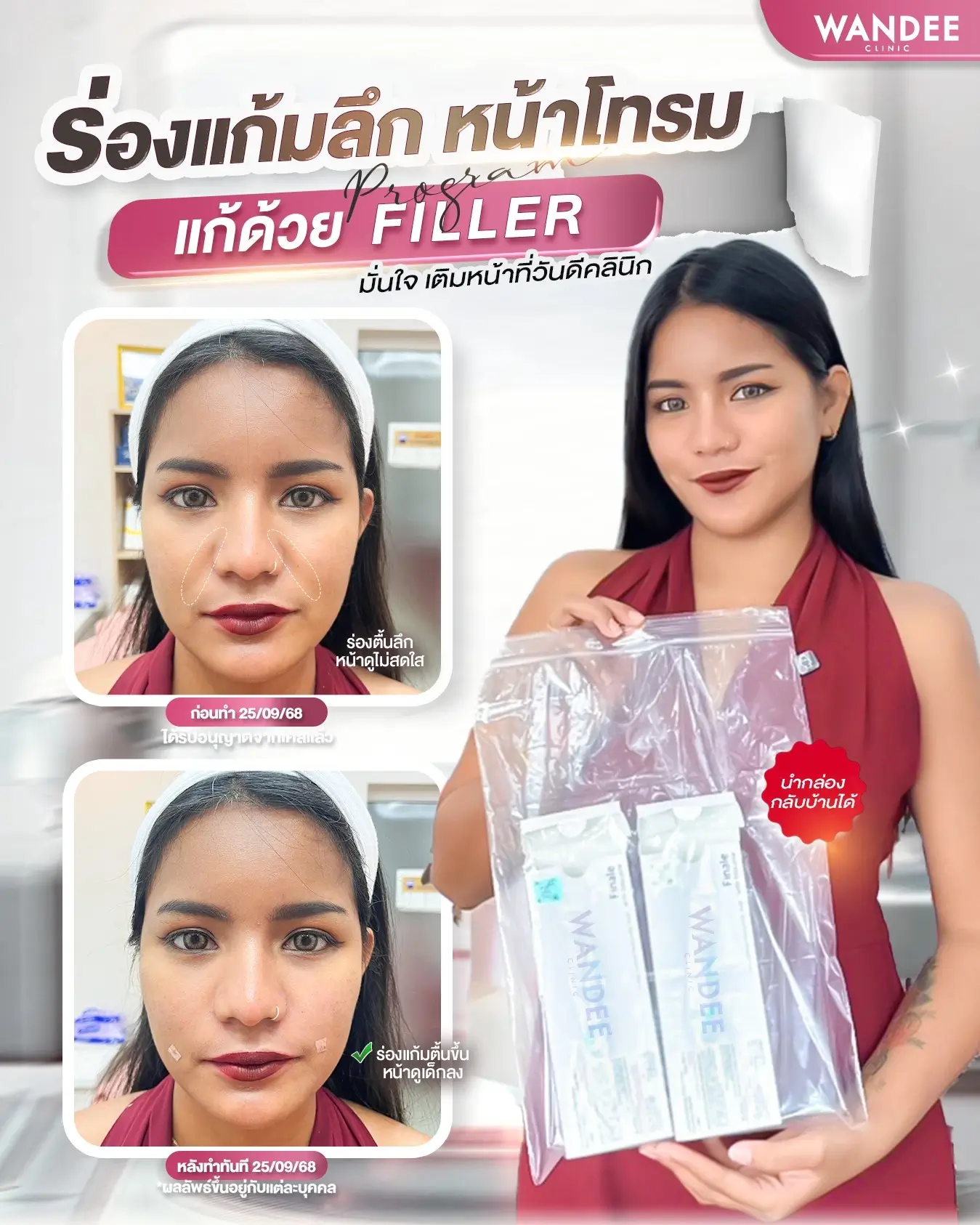 ร่องแก้มลึก หน้าโทรม