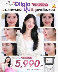 ยุบให้สุด! ทุกจุดไขมันบนหน้า