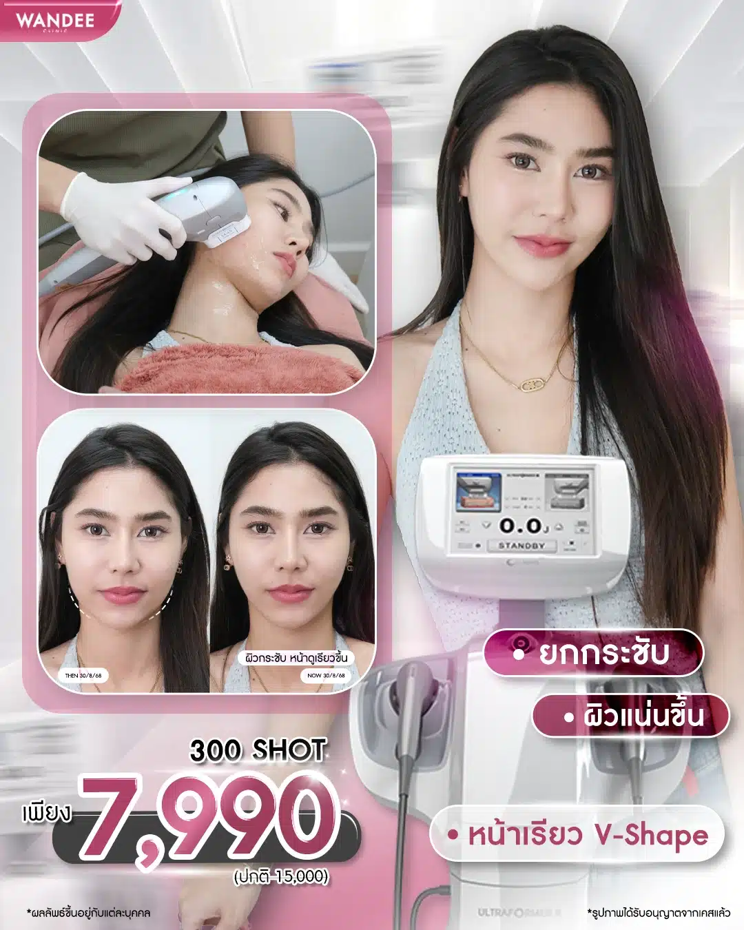 ยกกระชับ ผิวแน่นขึ้น 💕 เผยกรอบหน้าเป๊ะทุกองศา