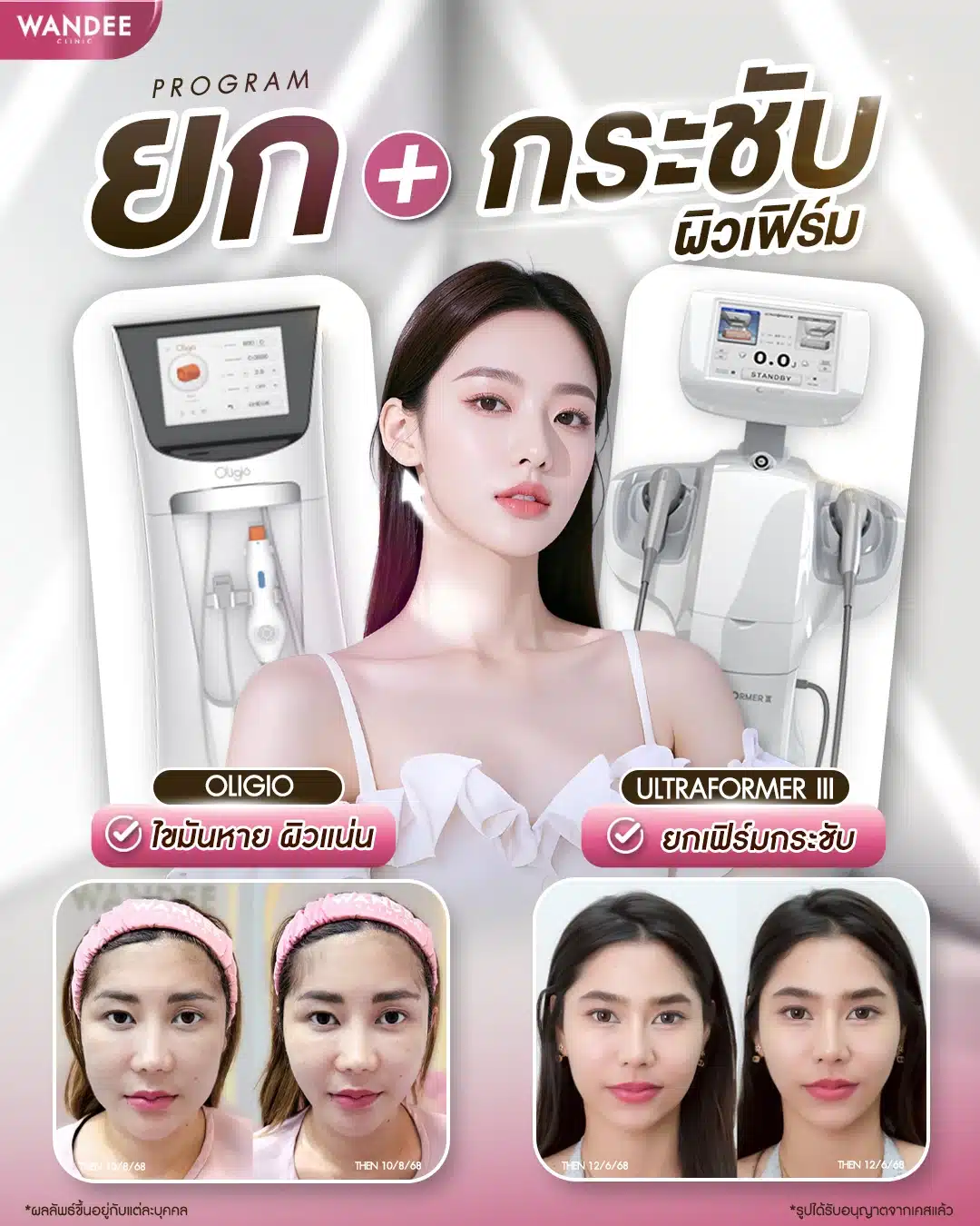 ยก+กระชับ ผิวเฟิร์มขั้นสุด