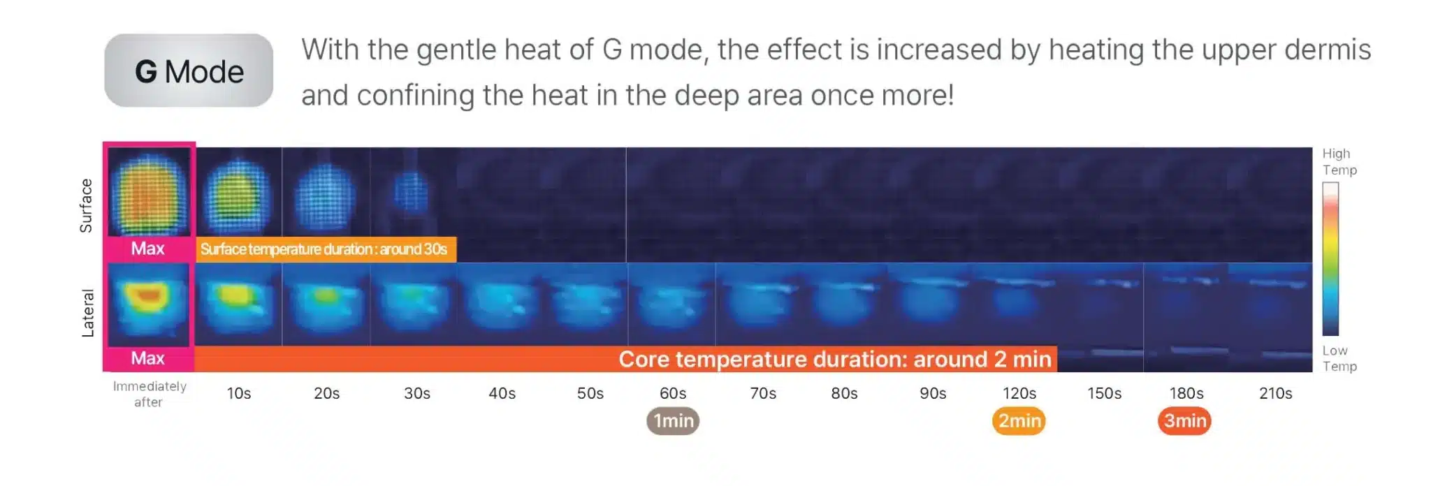 โหมดการทำงานของเครื่อง Oligio X G Mode