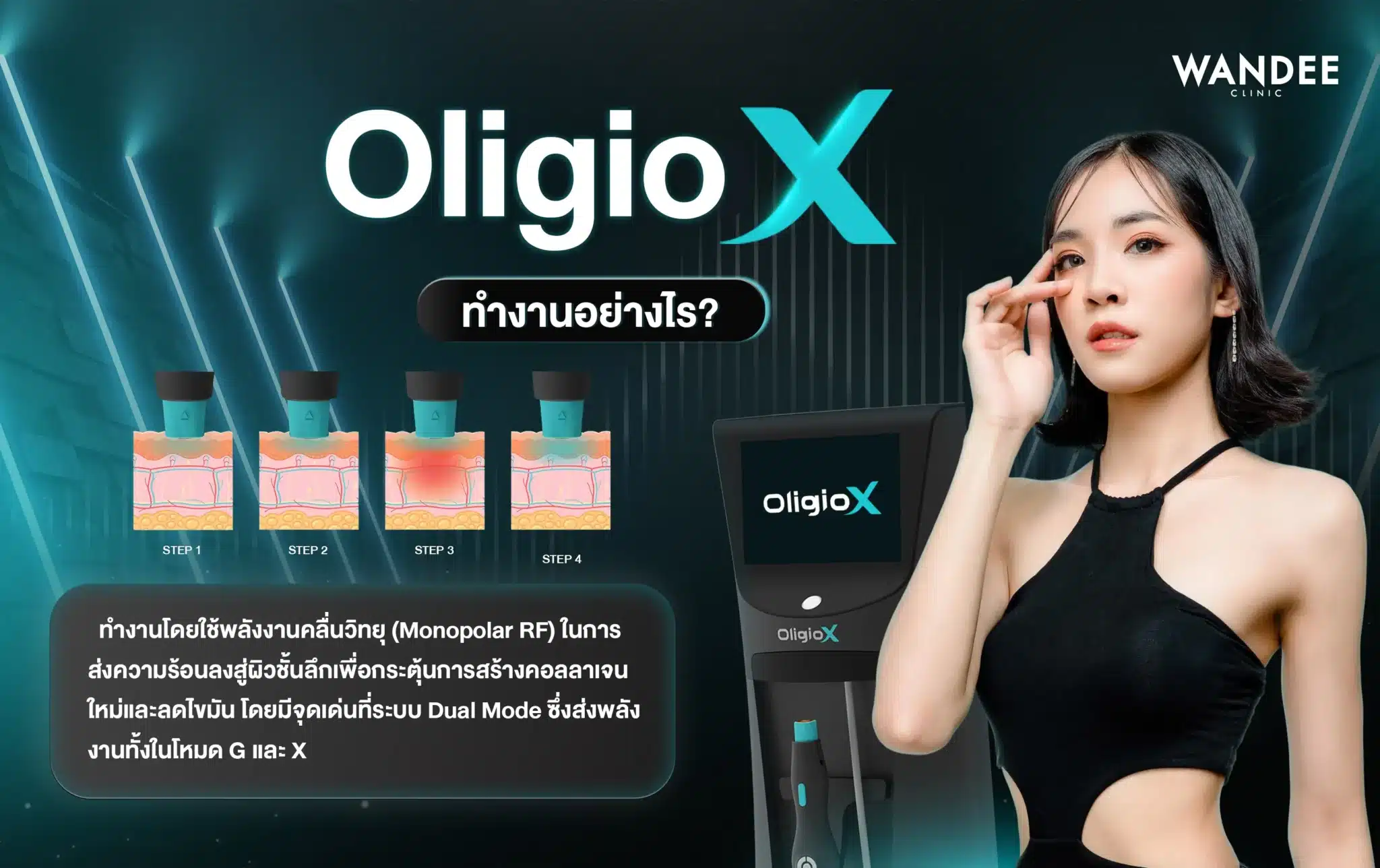 Oligio X ทำงานอย่างไร?
