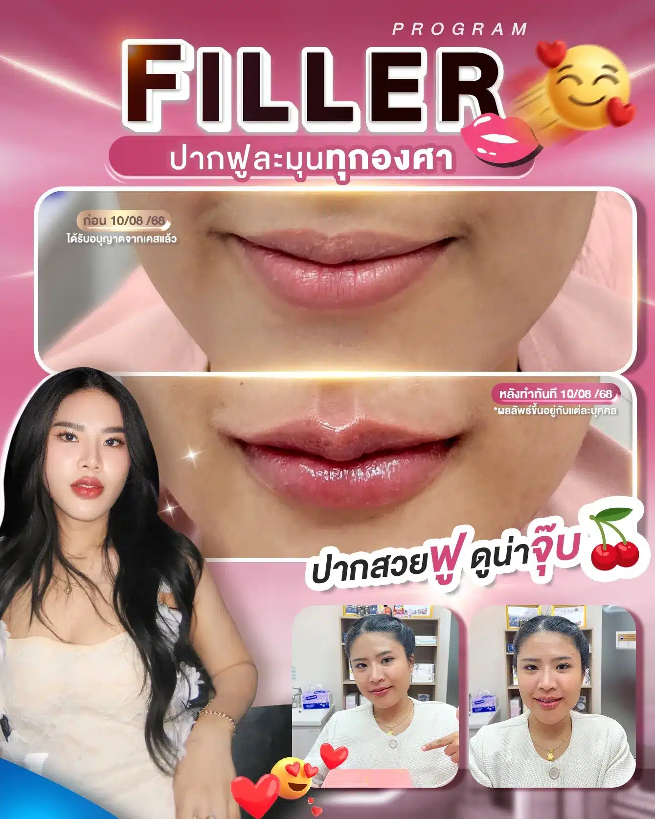 ปากฟูละมุนทุกองศา