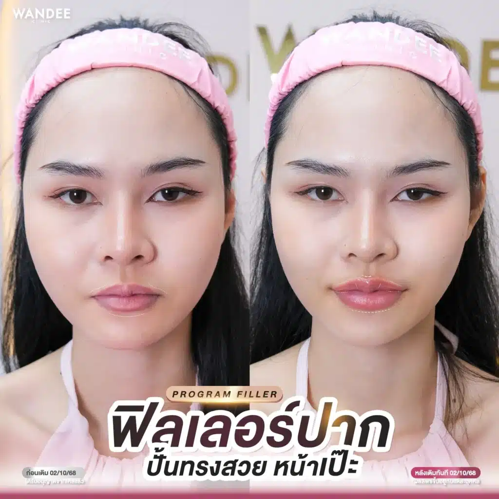 Just add a little bit