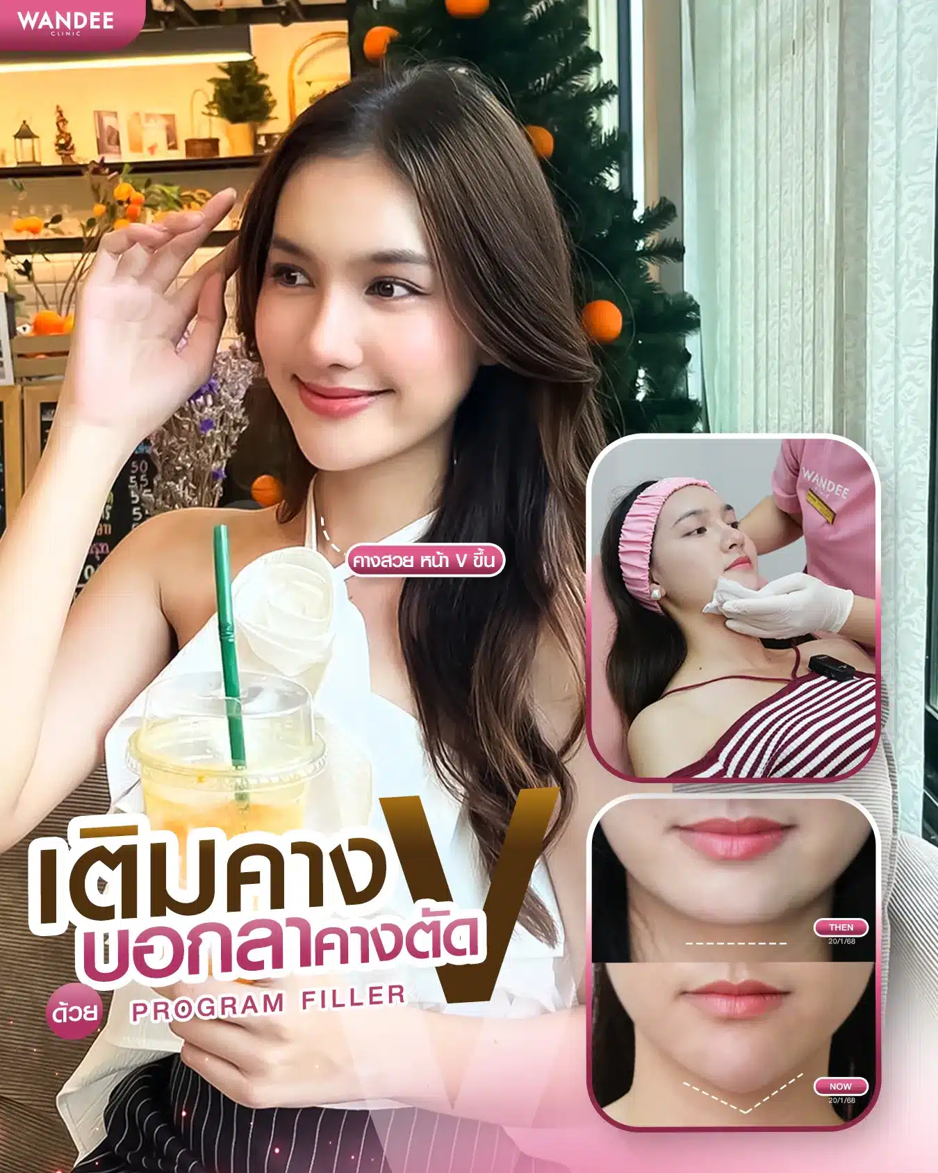 รีวิว ฟิลเลอร์คาง Wandee Clinic