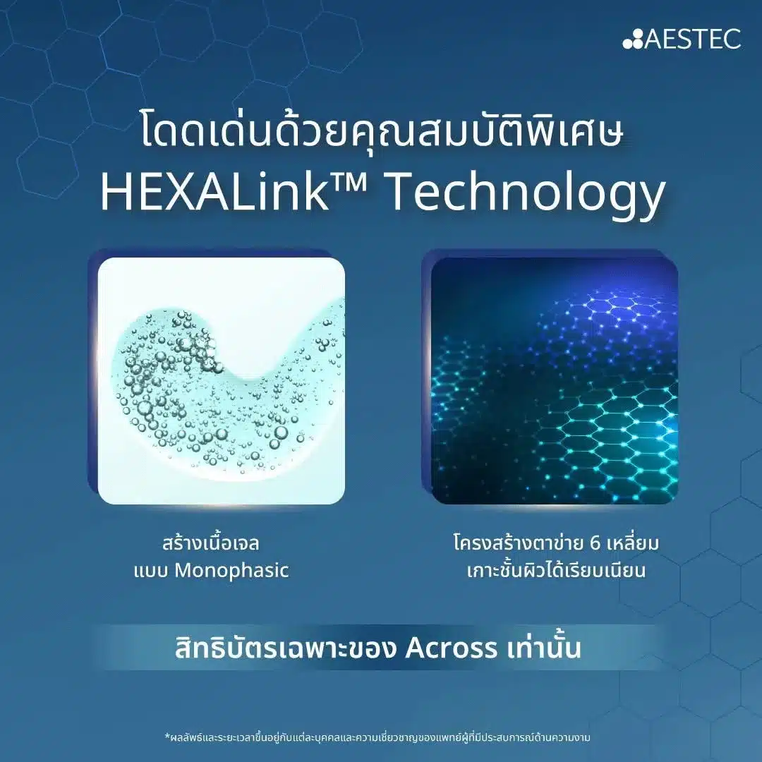 Revolax Filler ดีมั้ย มาจากประเทศอะไร อยู่ได้นานแค่ไหน?