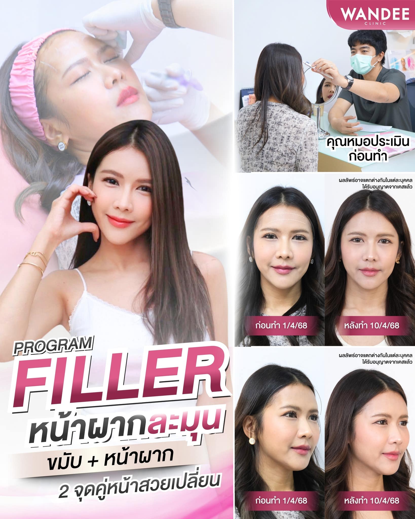 รีวิวโปรแกรมฟิลเลอร์