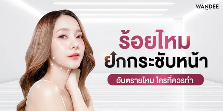 ร้อยไหม ยกกระชับหน้า